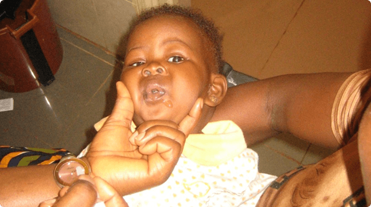 Smiling infant cared for at Niger Foundation Hospital after vaccination